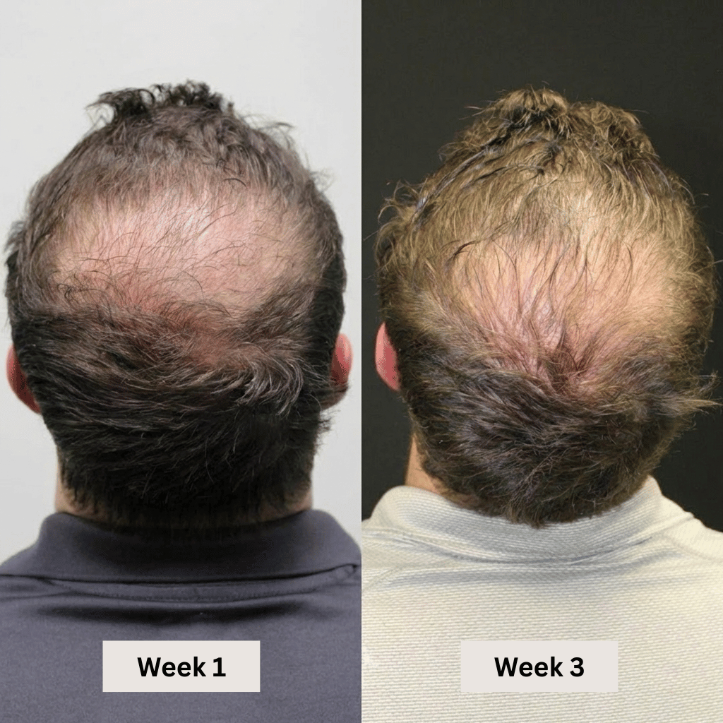 Circadian Sunrise Wake-Up System