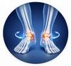 Unstable Gait Balance.