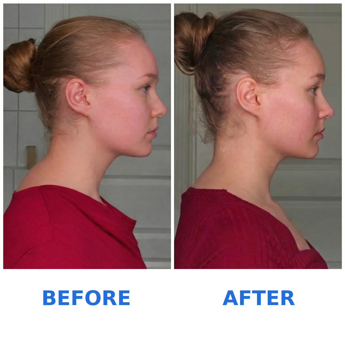 Cervex™ Neck Stretcher