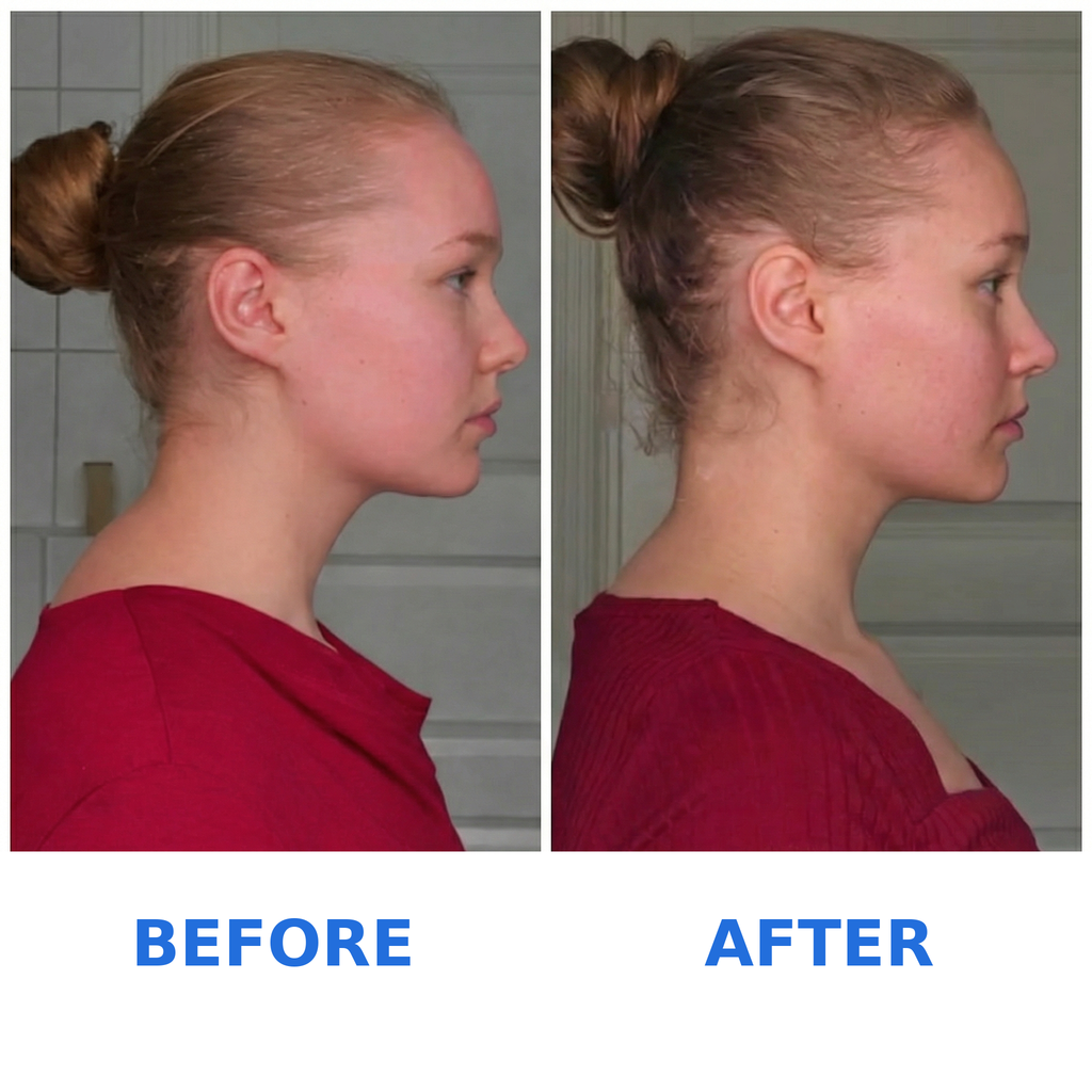 Cervex™ Neck Stretcher