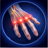 Chronic Finger Stiffness