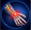 Stroke Recovery