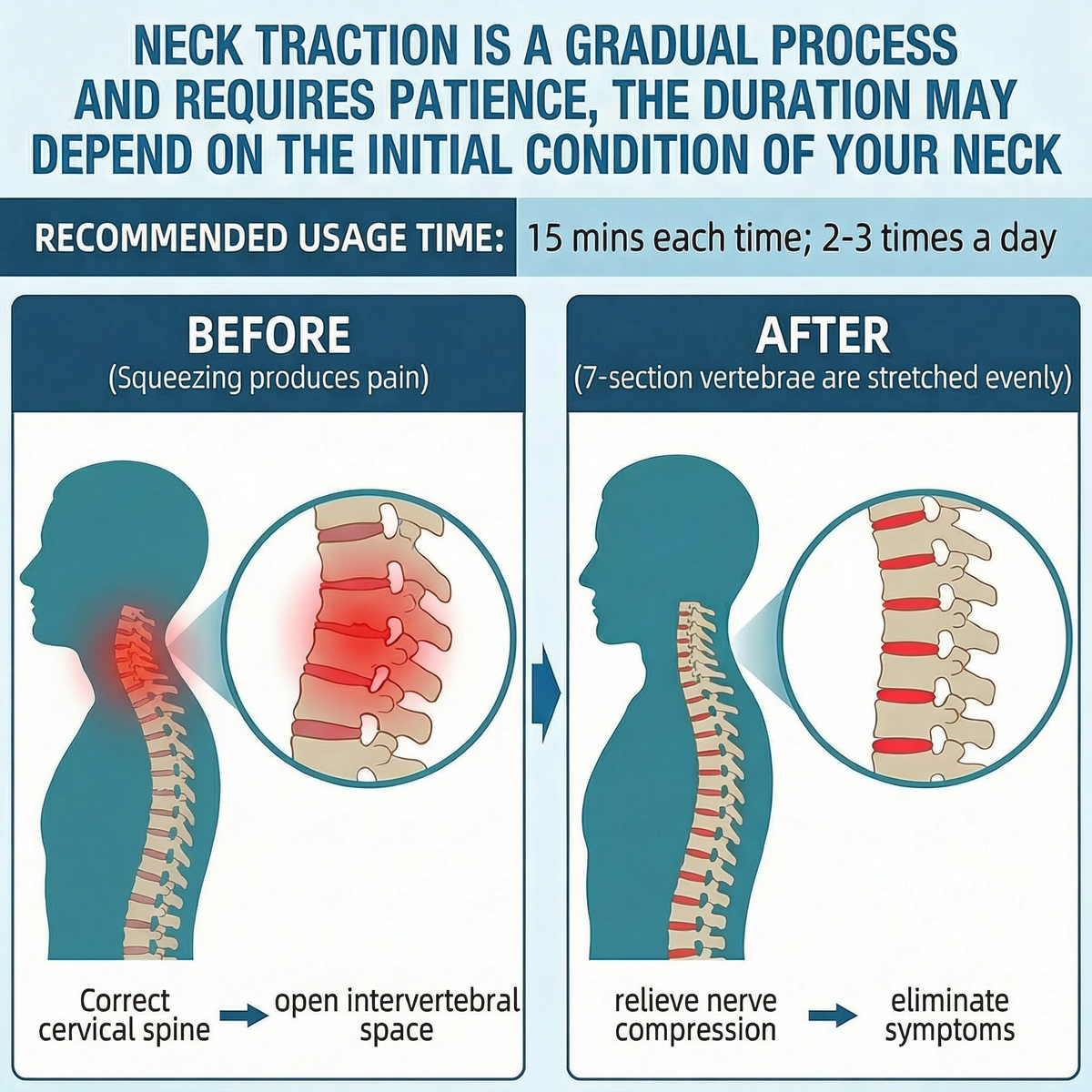 Cervex™ Neck Stretcher