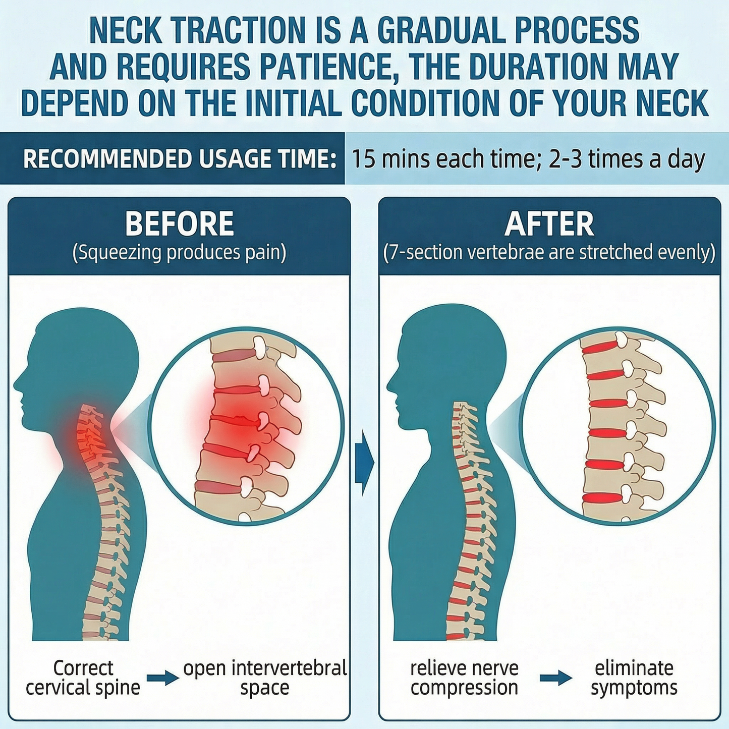 Cervex™ Neck Stretcher