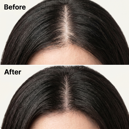 Norwood - Scalp Revival Bar