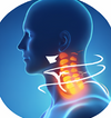 Neck Discomfort
