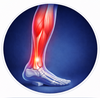 Lower Leg & Ankle Fatigue.